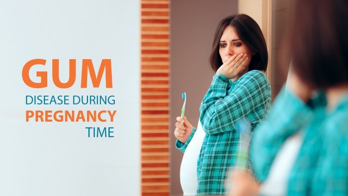 Gum Disease During Pregnancy Time