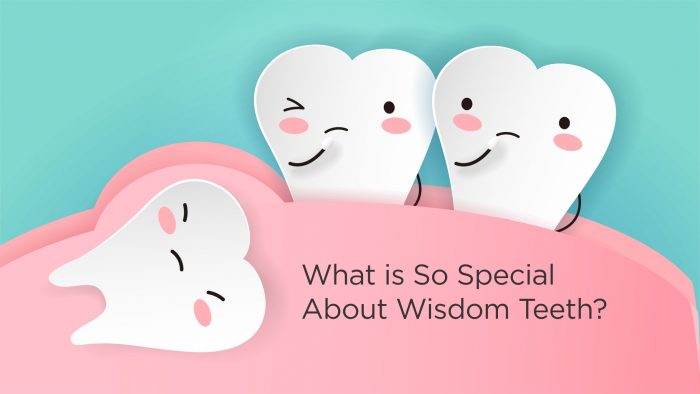What Is So Special About Wisdom Teeth?