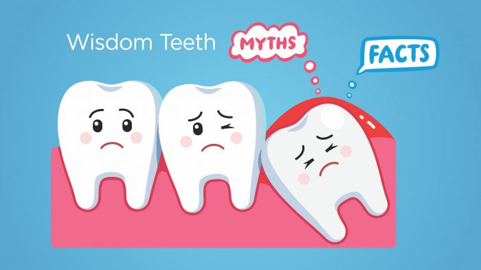 Wisdom Teeth - Myths Vs Facts