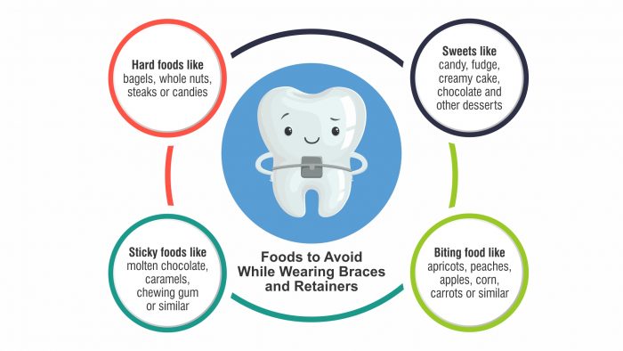 Keeping Your Braces and Retainers in Good Health - Tips and Suggestions