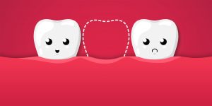 Types of Missing Teeth & Treatment options