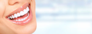 What are dental veneers and what are their benefits?