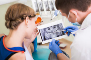 Why do dental implants fail?