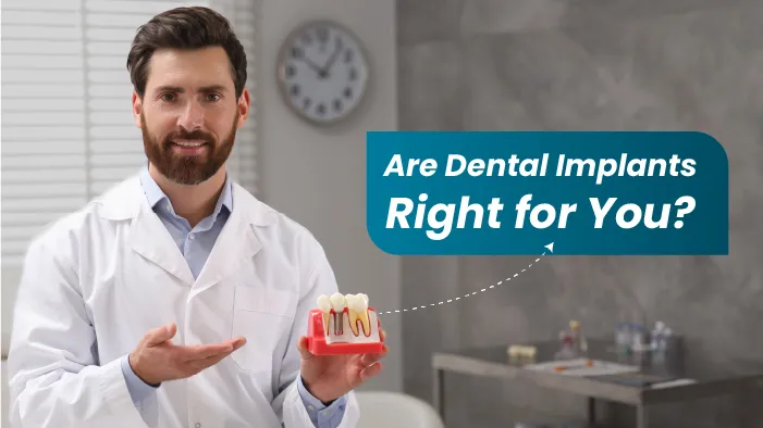 Are Dental Implants Right for You?