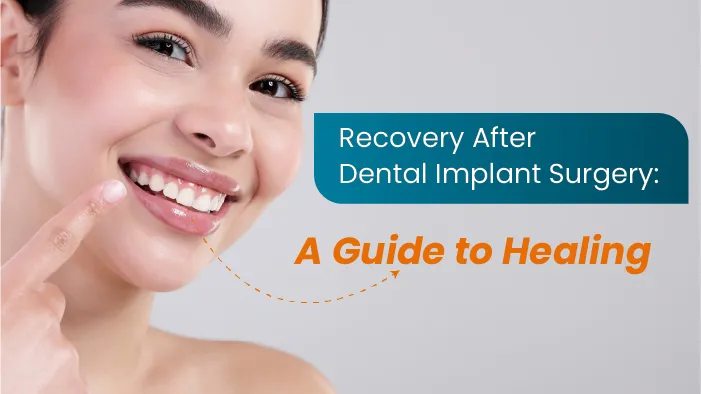 Recovery After Dental Implant Surgery: A Guide to Healing