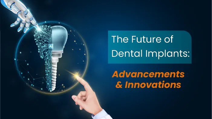 The Future of Dental Implants: Advancements and Innovations