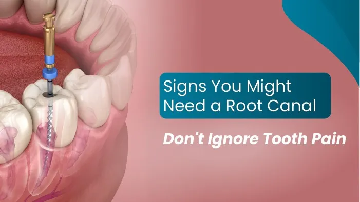 Signs You Might Need a Root Canal: Don't Ignore Tooth Pain