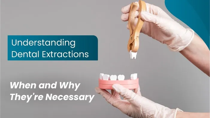 Understanding Dental Extractions: When and Why They're Necessary