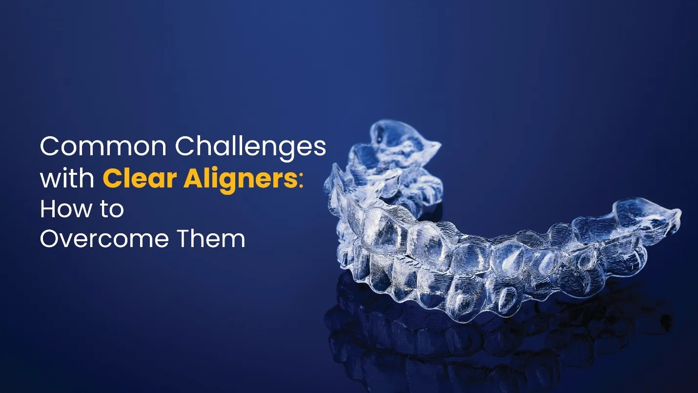 Common Challenges with Clear Aligners: How to Overcome Them