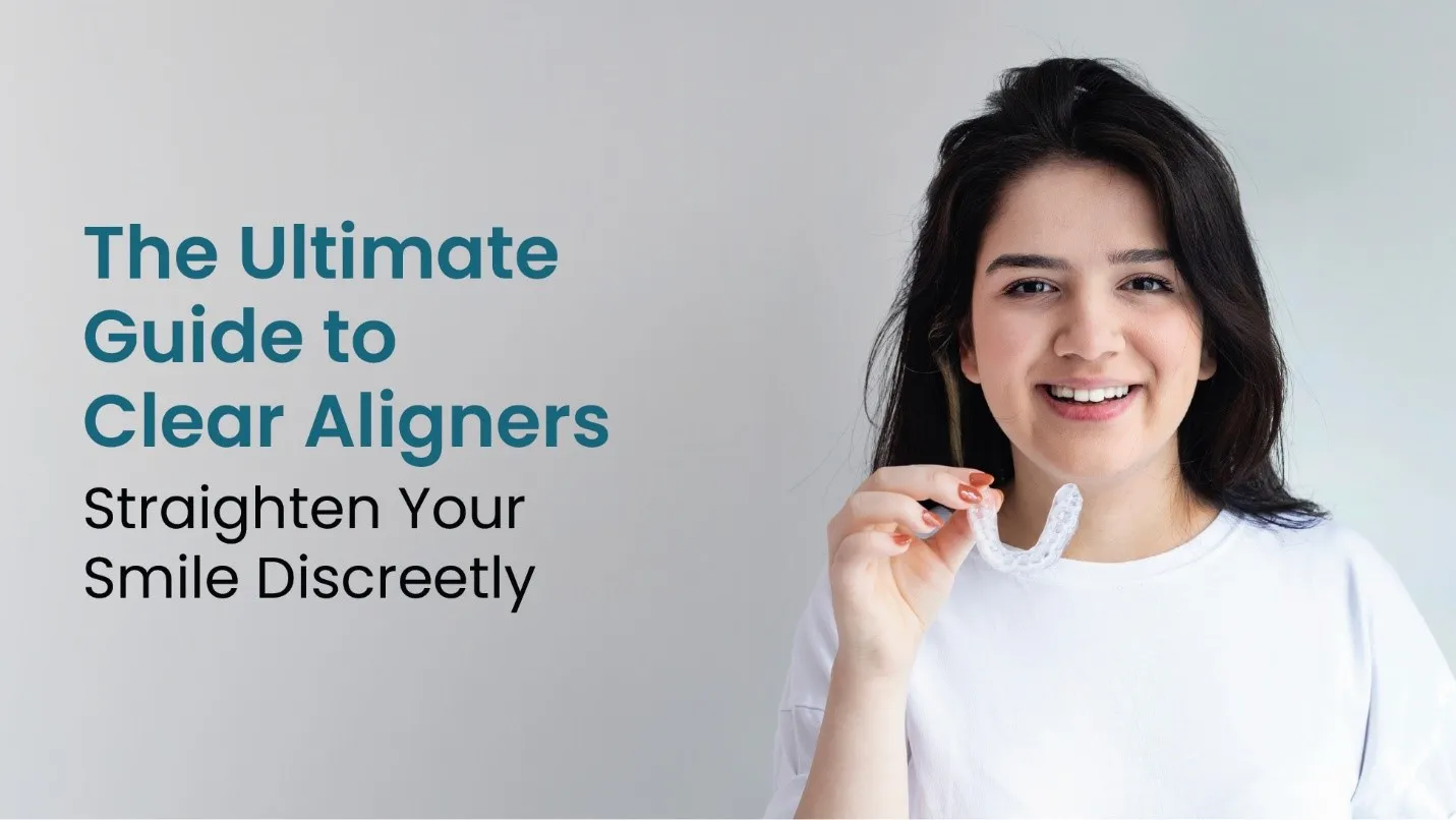 The Ultimate Guide to Clear Aligners: Straighten Your Smile Discreetly