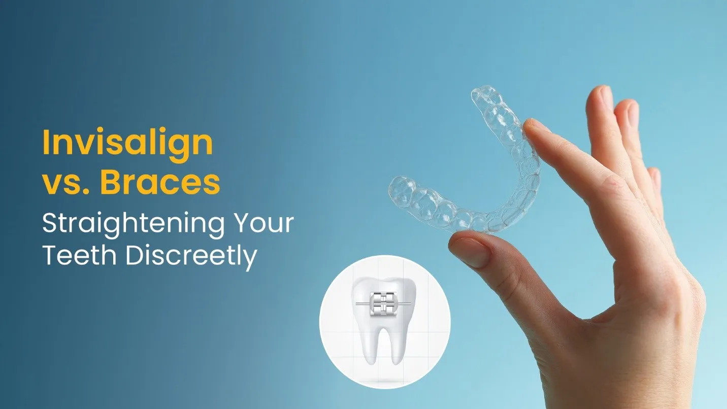 Invisalign vs. Braces: Straightening Your Teeth Discreetly